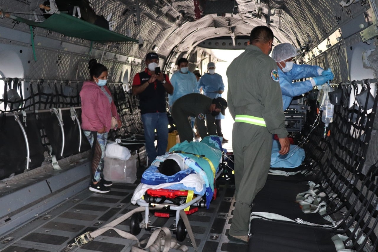 Trasladaron a Lima a paciente con quemaduras en el 60% del cuerpo