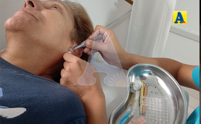 EsSalud Moyobamba trata a pacientes que padecen de insomnio y de estrés